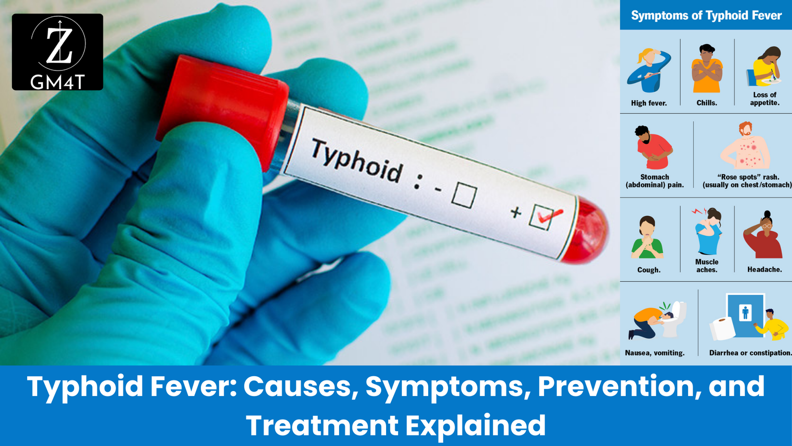 Typhoid Fever: Causes, Symptoms, Prevention, and Treatment Explained